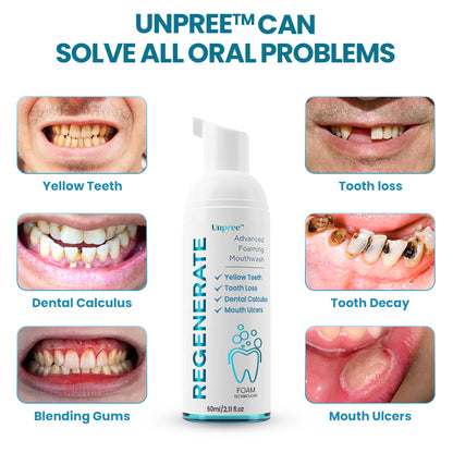 Unpree™ Regenerate Teeth Mouthwash - Foam Technology Solve All Oral Problems