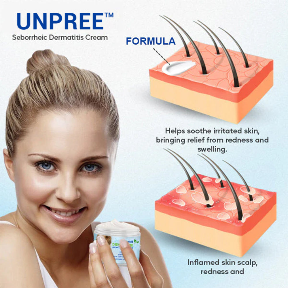 Unpree™ Seborrheic Dermatitis Cream