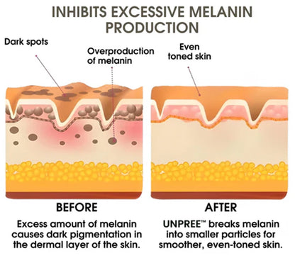 UNPREE Vitamin C Skin Whitening Serum