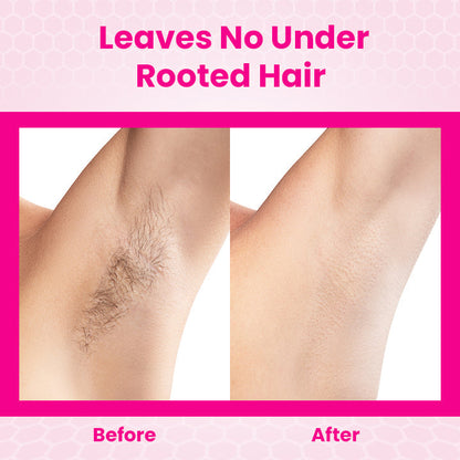 Unpree™ BeeMousse Hair Removal